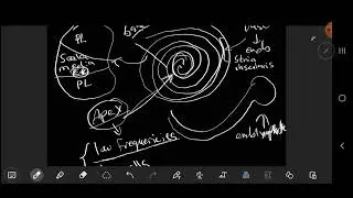 Otolaryngology - ENT - Meniere's disease