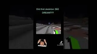 That Skeleton 360 Dream! How? #Short
