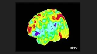 Redes neuronales en el cerebro humano