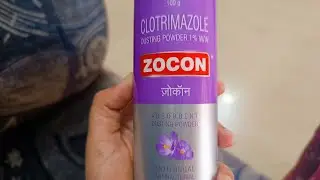 Zocon Dusting Powder। Best & Safe for treating PRICKLY HEAT Or घमोरिया in Babies & Adults।