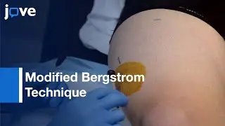 Modified Bergstrom Technique for Human Skeletal Muscle Biopsy | Protocol Preview