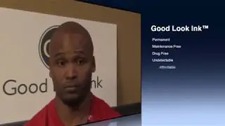 Former hair transplant patient Terrence shares his SMP results