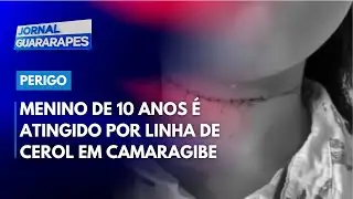 Menino de 10 anos é atingido por linha de cerol durante passeio de bicicleta