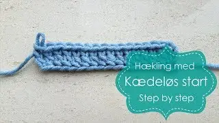 Kædeløs start