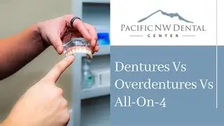 Dentures vs Overdentures vs All-On-X