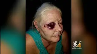 Uber Driver Who Was Attacked Says She's Alive Because She Fought Back
