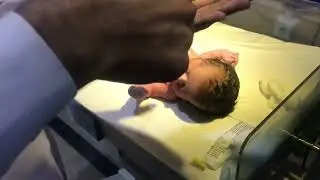 🍼 IV Line Procedure for Baby | Mild Infection Care | Newborn Nursing Steps