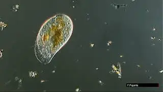 CHILODONELLA CILIADO