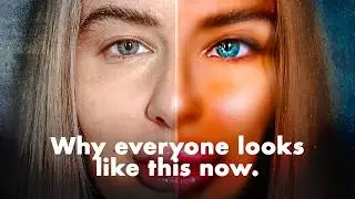The high cost of 'Instagram face'