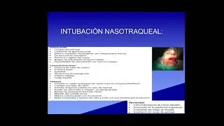 Intubaci&oacute;n y Laringoscop&iacute;a. Material educativo para Estudiantes de Medicina.UNEFM. 2025.