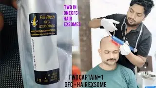 New update 2in one GFC ki sath hair exsomes |  #hairgrowth ki new formula new medicine💊 GFC exsome!