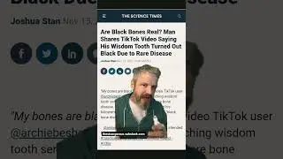 What is black bone disease?