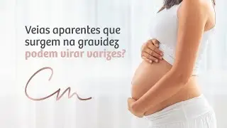 Veias aparentes que surgem na gravidez podem virar varizes?