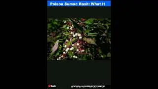 Poison Sumac Rash: What It Looks Like and How to Prevent It|Shorts