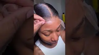 Wow?🙀Can't Believe This Clear Lace Wig Melt Her Skin So Natural🔥Clean Hairline#shorts#xrsbeautyhair