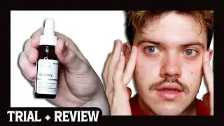 the ordinary multi-peptide eye serum | trial + review