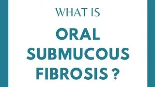 WHAT IS ORAL SUBMUCOUS FIBROSIS (OSMF)?