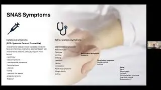 Systemic Nickel Allergy Syndrome (SNAS) - An inconspicuous condition