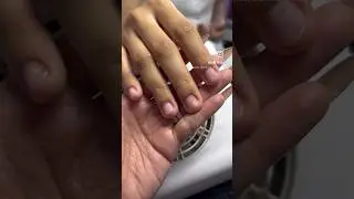 Nail biter transformation #nailbiter #sculptednails #nailtransformation #nailextension
