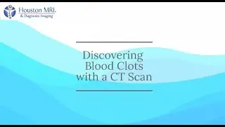 Discovering Blood Clots with a CT Scan