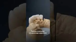 Абсолютный контроль качества. Исключительный сервис🙌 #зуботехническаялаборатория #москва #camtech