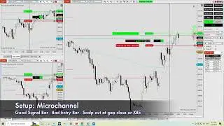 How to Enter in a Microchannel - MC403 - Below Expected Performance | Zen Tech Trading