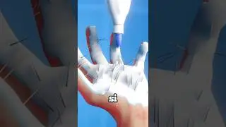 IL MIGLIOR METODO PER TOGLIERE UNA SPINA!