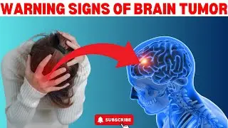 10 Subtle Warning Signs That You Have A Brain Tumor - Assessing Your Risk