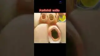 Acid- producing parietal cells( oxyntic cells ). #stomach #acid