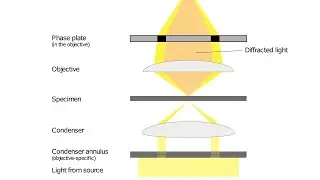 Phase Contrast Microscope |Principle |Working Mechanism |Urdu /Hindi