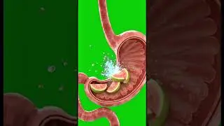 What Happens to Your Body When You Eat Guava? 🍈 #guava#guavabenefits#healthyfruit#healthshorts