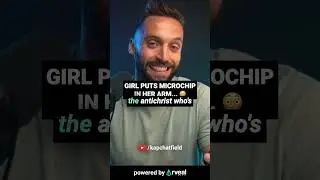 Girl gets MICROCHIP in her arm?? 😳🤖 #jesus #christianity #endtimes #bible #spirituality #truth