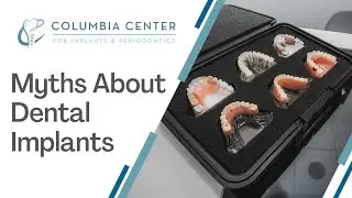 Common Myths About Dental Implants
