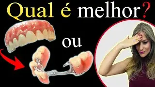 🟢Что ЛУЧШЕ, полный протез или съемный протез? В чем разница между двумя протезами?