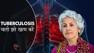 TB in India - National Strategic Plan for Tuberculosis Elimination explained