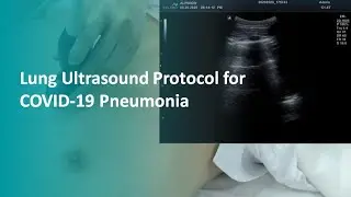 Lung Ultrasound protocol for COVID-19