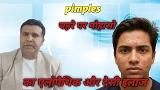 (Pimples )मोहासे क्यों होते कारण,लक्षणऔर इलाज 