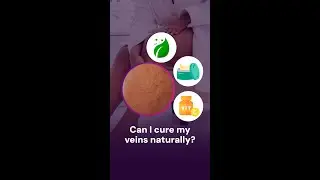 Can I cure my veins naturally?