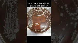 Germ tube test for Candida