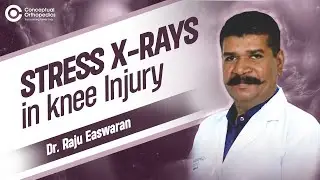 Stress X-rays in Knee Injury Dr. Raju Easwaran