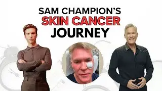 Sam Champion's Skin Cancer Journey Featuring Dr. Anthony Rossi - Good Morning America