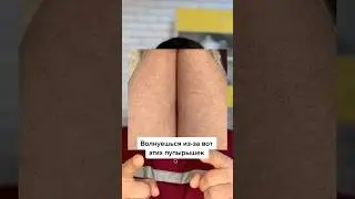 Почему у тебя &laquo;гусиная кожа&raquo;.