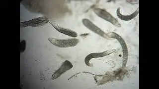 Tylodelphys clavata metacercariae (Digenea) in the vitreous humor of perch, Perca fluviatilis
