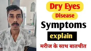 Dry Eyes Disease के मरीज के साथ खास बातचीत | Meibomian Gland Dysfunction patient के साथ Discussion.