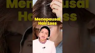 Menopausal Hair loss | Causes Of Hair Loss In Women | Chandra Hair Clinic