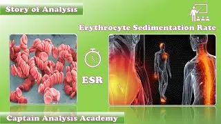 E150. Erythrocyte sedimentation rate اسرار لاول مرة فى سرعه الترسيب #نظرى