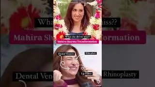 Mahira Sharma Shocking Transformation 🤯 #mahirasharma #mohammedsiraj #biggboss #teeth #bollywood