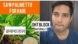 सॉपा| Saw Palmetto for hair| Receding hairline Regrowth| Hairfall remedy| Hairloss| Dandruff| Hindi