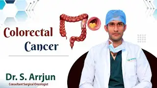 What is Colorectal Carcinoma? || Colorectal Cancer Diagnosis and Treatment || Dr S Arrjun || Renova