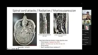 &ldquo;What Should I Do about My Neuroendocrine Cancer?&rdquo; (Amit Gattani)